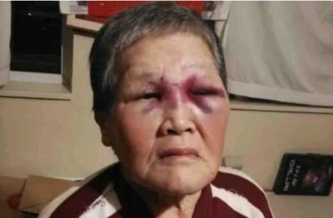 反击恶徒的华人老太 宣布捐出所有捐给她的89万捐款
